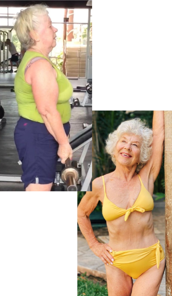 Joan before & after